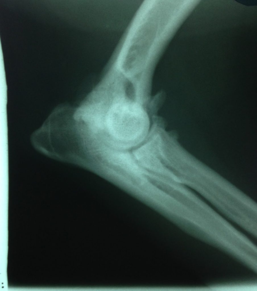 Arwens elbow xray